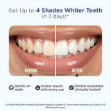 GuruNanda Whitening Strips - 7-Day Treatment, Infused with Coconut Oil